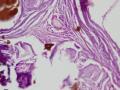网膜结节图8
