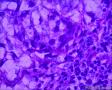 分享！乳腺透明细胞癌图24