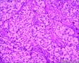 分享！乳腺透明细胞癌图17