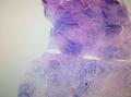 淋巴结内血吸虫卵图1