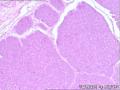 鼻部新生物10+年    急要报告！图3