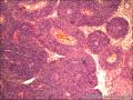 肠系膜肿物图1