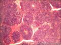 肠系膜肿物图10