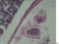 临床诊断急性阑尾炎，没见到中性粒细胞怎么报告？图5