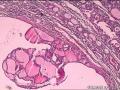 右甲状腺组织图13