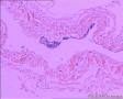 睾丸鞘膜图6
