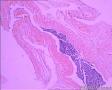 睾丸鞘膜图1