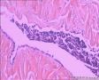 睾丸鞘膜图5