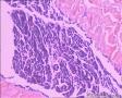 睾丸鞘膜图4