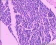 睾丸鞘膜图3