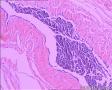 睾丸鞘膜图2