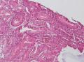 胃窦粘膜图2