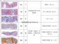 肝脏病理学讲座稿件图48