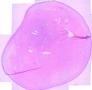 2013年第14期（总第66期）---阴道壁囊肿（已点评）图1