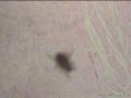 子宫肌瘤切片中发现虫子一个，是什么虫？图2