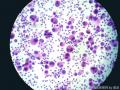 值得推荐的细胞免疫组化制片方法--液基薄层制片！图5
