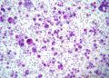 值得推荐的细胞免疫组化制片方法--液基薄层制片！图3