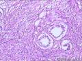 前列腺 上皮细胞空泡化有问题吗 尿道上皮可报腺性尿道炎？图10