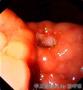 胃黏膜活检—大体观与组织学图片图1