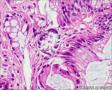 结肠粘膜，M/24，寄生虫？图18
