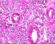 2014年第17期（总第96期）——子宫肌壁肿物图5