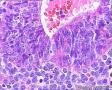 子宫内膜腺体这么多的核仁需要注意吗？间质细胞呢？图8