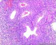子宫内膜腺体这么多的核仁需要注意吗？间质细胞呢？图5