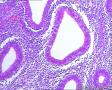 子宫内膜腺体这么多的核仁需要注意吗？间质细胞呢？图2