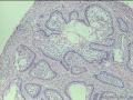 经典病例学习--成釉细胞瘤图16