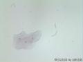 尿路上皮细胞图4