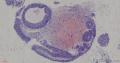 膀胱粘膜图3