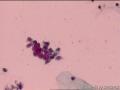 如此近似裸核的小细胞是什么细胞？图7