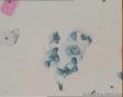 宫颈细胞图19