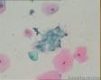 宫颈细胞图4