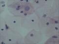 是中层鳞状上皮细胞还是ASC-US图4