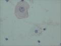 尿液细胞学，有问题吗图3