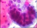 宫颈细胞图15