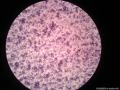 非妇科液基细胞学图1
