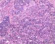 宫颈液基细胞图10