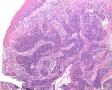 宫颈液基细胞图8