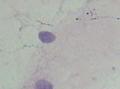宫颈细胞，如何报结果呢，里面是滴虫吗？图10