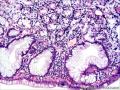 十二指肠球部粘膜组织图13