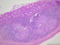 请教各位老师，这个大鼠大肠的淋巴组织中间，有团淡然的区域是否正常，怎么下诊断结果呢？图2