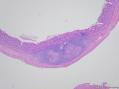 请教各位老师，这个大鼠大肠的淋巴组织中间，有团淡然的区域是否正常，怎么下诊断结果呢？图1