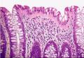 炎症性肠病 | 上皮细胞和粘膜间质图13