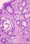 炎症性肠病 | 上皮细胞和粘膜间质图9