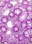 炎症性肠病 | 上皮细胞和粘膜间质图10