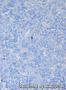请问，细胞学上看是肥大细胞瘤，为何组织学甲苯胺蓝染色为阴性？图6
