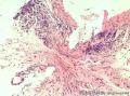 结肠黏膜图12