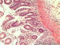 结肠黏膜图7